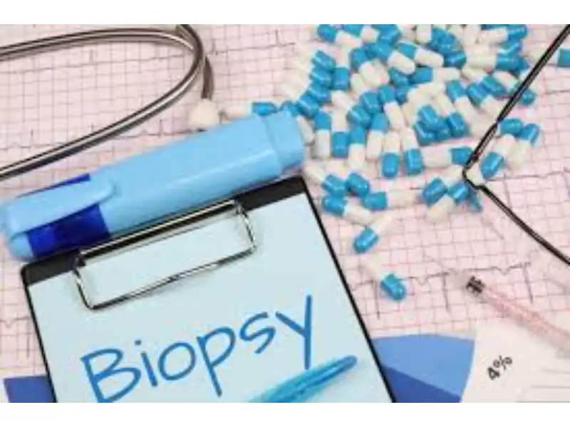 FNAC & Biopsy in Indore