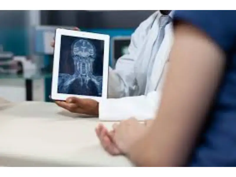 Digital X-ray in Indore