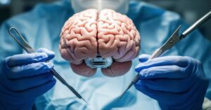 brain tumor surgery in indore